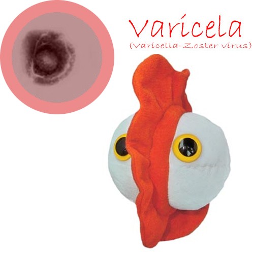 GiantMicrobes (peluche) - Zoster Virus (Varicela)